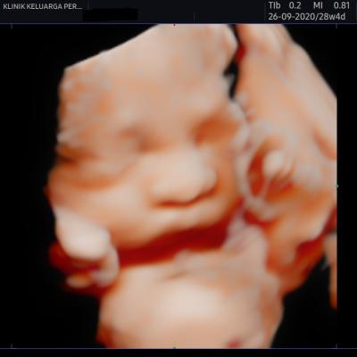 Imbasan Ultrabunyi Kehamilan 1