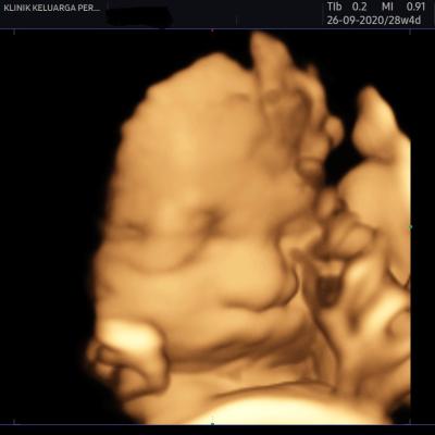Imbasan Ultrabunyi Kehamilan 2