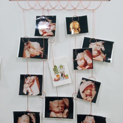 Imbasan Ultrabunyi Kehamilan